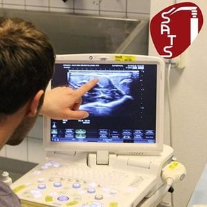 Hvordan ser en datings ultralyd ud?
