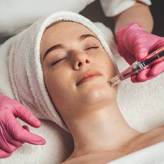 Dermapen en Madrid, 28 May | Event in Madrid | AllEvents