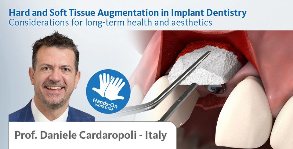 Hard and Soft Tissue Augmentation in Implant Dentistry ...