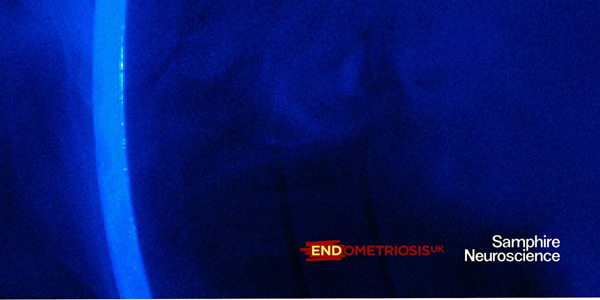 The Neuroscience of Endometriosis with Dr Emilė Radytė (London & Online), 9 December | Event in London