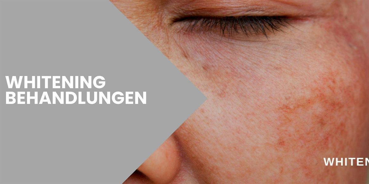 Whitening Aufhellende Behandlungen, 15 March | Event in Berlin | AllEvents