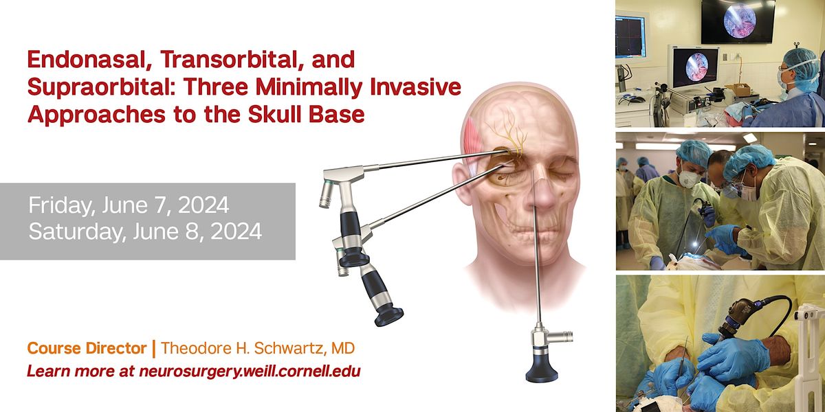 Endonasal, Transorbital, Supraorbital: 3 MIS Approaches to Skull Base ...