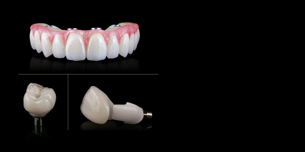Implant Woes Tackling Restorative Complications, MicroDental