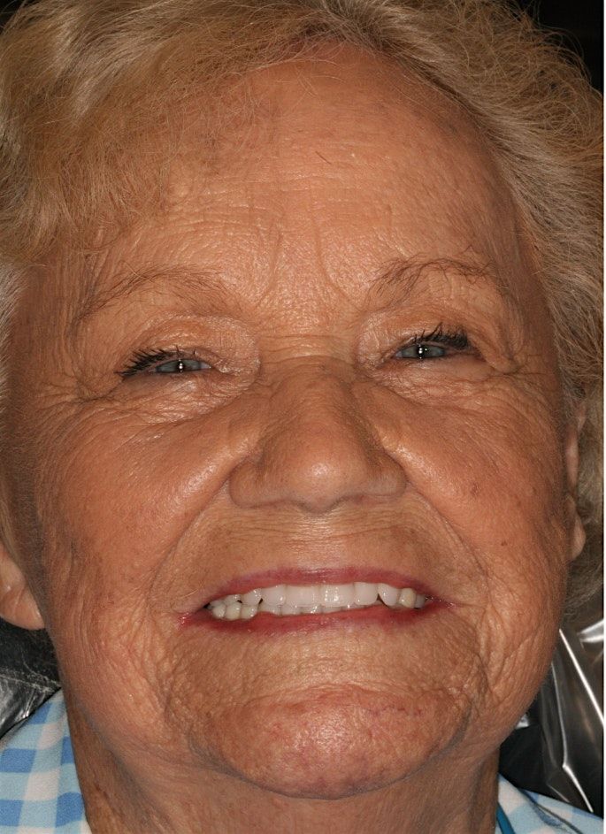 Removable Partial Dentures: Design and Fabrication (12 CE Credits), 21 November | Event in Macon | AllEvents