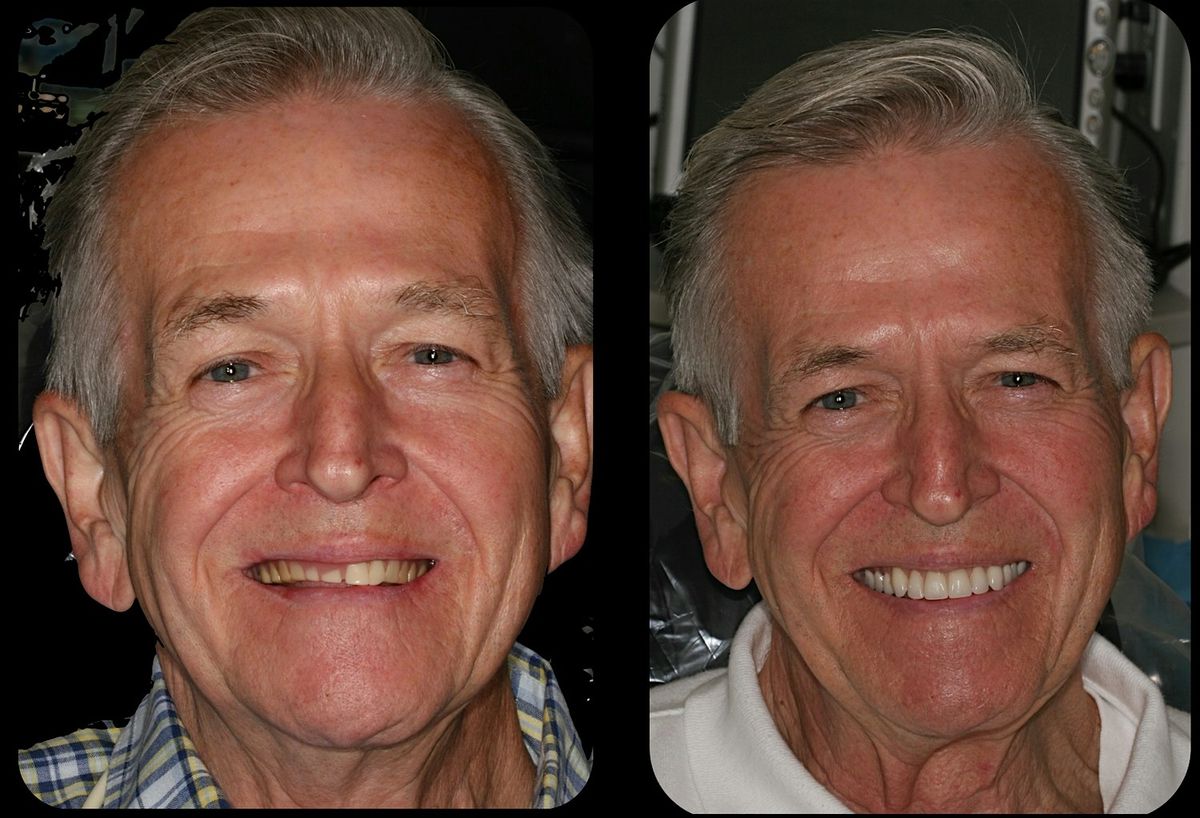AUGUST 2025 Denture Bootcamp, 1 August | Event in Macon | AllEvents
