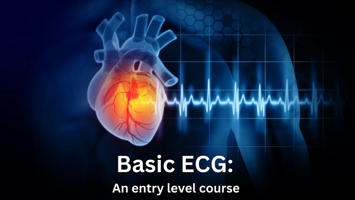 Basic ECG: An entry level course (2 of 3), Memorial Medical Center ...