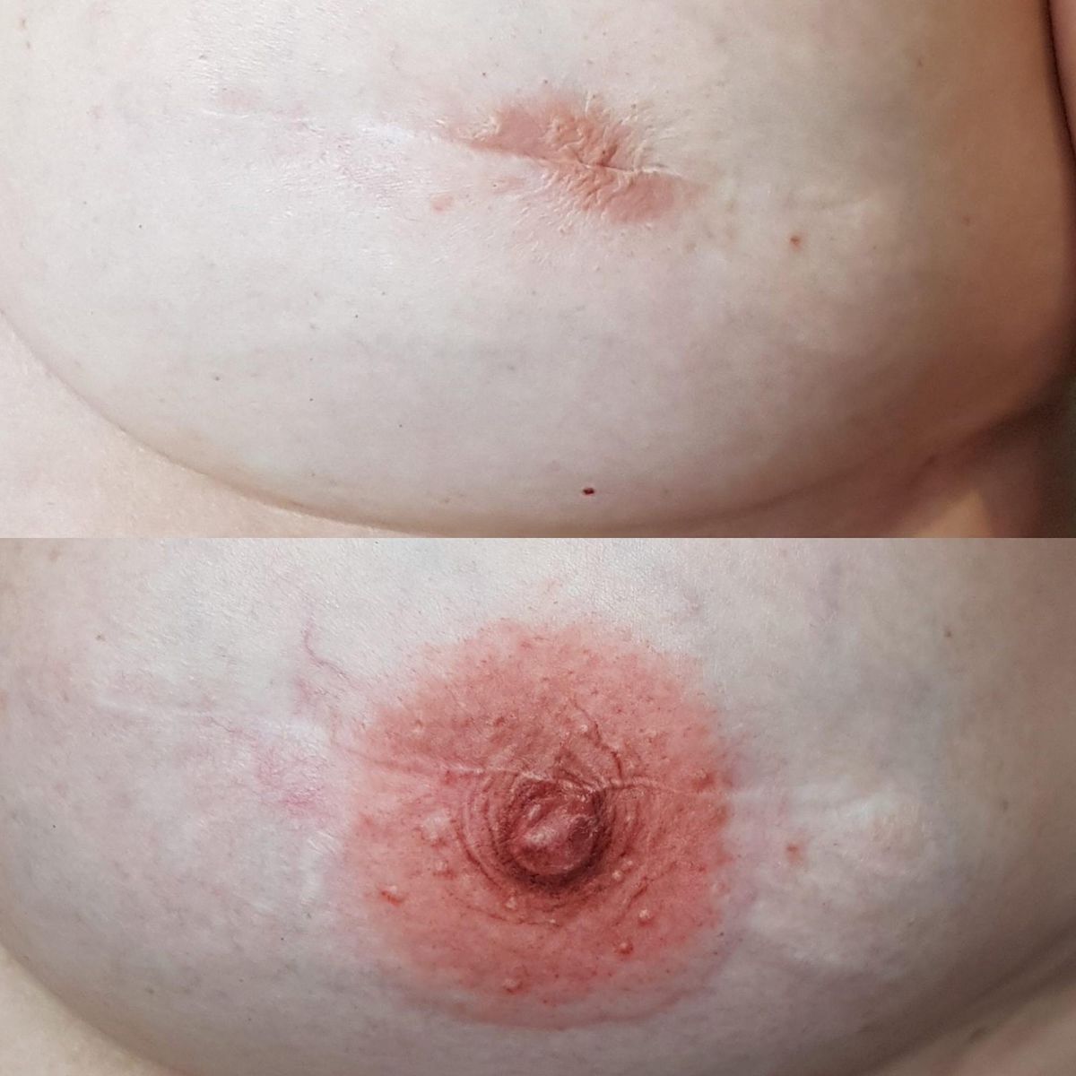 LEARN 3D AREOLA IN GREENVILLE. START YOUR PERMANENT MAKEUP CAREER NOW., 2441 Laurens Rd, Greenville, February 17 2023 LEARN 3D AREOLA IN GREENVILLE. START YOUR PERMANENT MAKEUP CAREER NOW., 2441 Laurens Rd, Greenville, February 17 2023