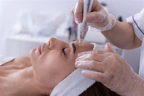 Microneedling Course, 1 January | Event in Dallas | AllEvents