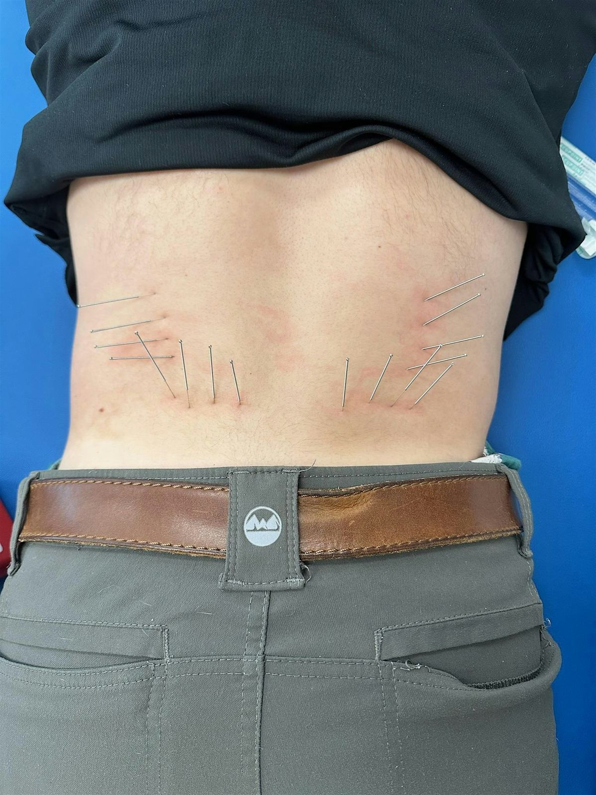 Advanced Dry Needling Level 2, 8 November | Event in Peoria | AllEvents