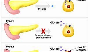 Diabetes Masterclass, 2 June | Event in Middlesbrough | AllEvents