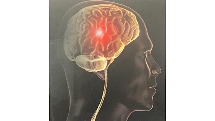 Brain Plasticity in Health and Disease, 27 February | Event in London | AllEvents