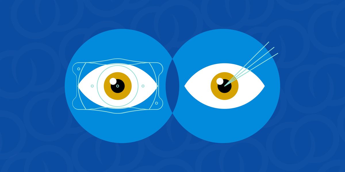 Eastside Optometrists & Paraoptometrists: Can EVO ICL and LASIK Coexist?, 17 June | Event in Bellevue