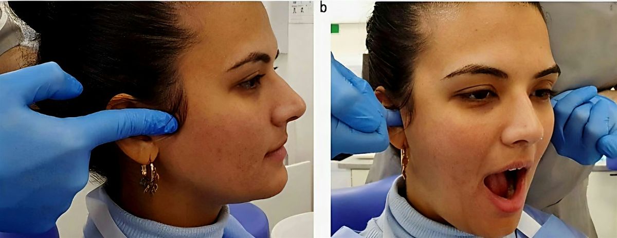 One Day Masterclass TMJ/Sinus Headache Course 22nd March 2026, 22 March | Event in London | AllEvents