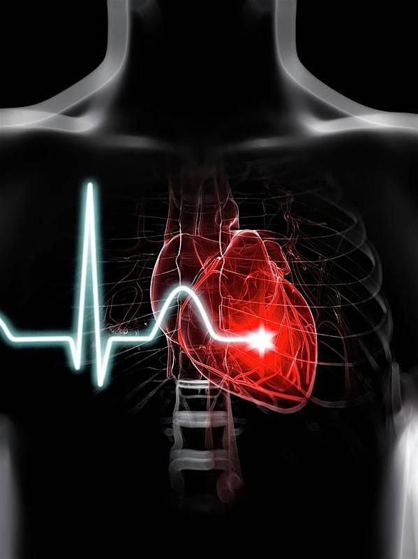 Presidio of Monterey Fire Department CPR Class, 21 July | Event in Seaside | AllEvents