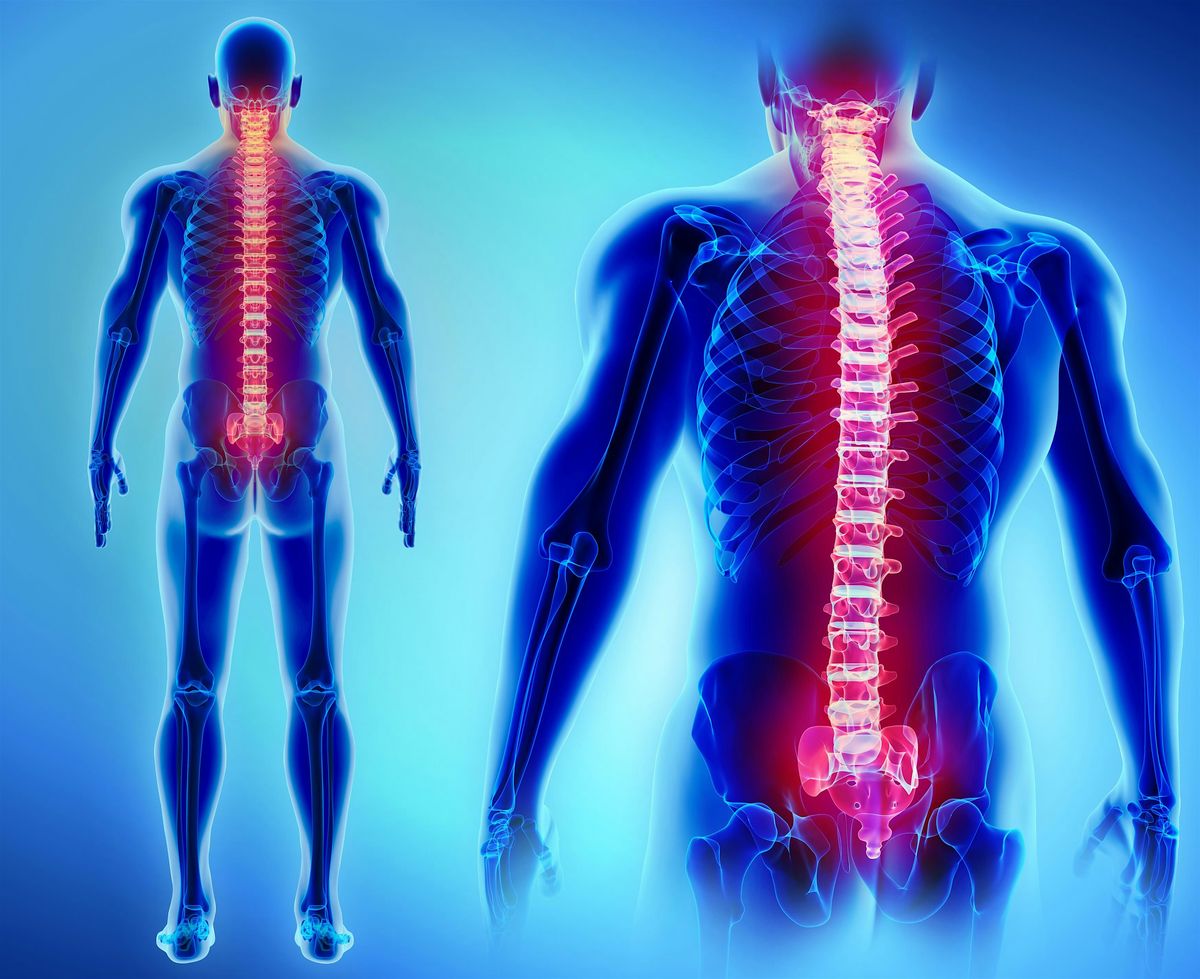 Metastatic Spinal Cord  Compression Study Day, 23 April | Event in Manchester | AllEvents