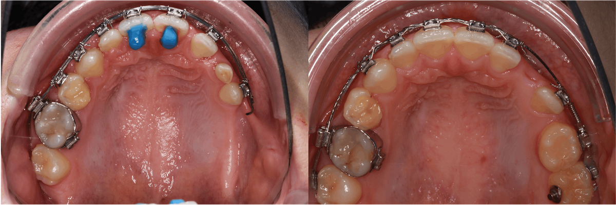 Charité Update - Autotransplantation, 17 January | Event in Berlin | AllEvents