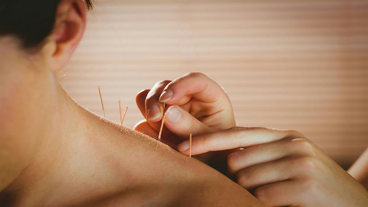 Cardiac Connection: Benefits of Acupuncture, 18 August | Event in Greer | AllEvents