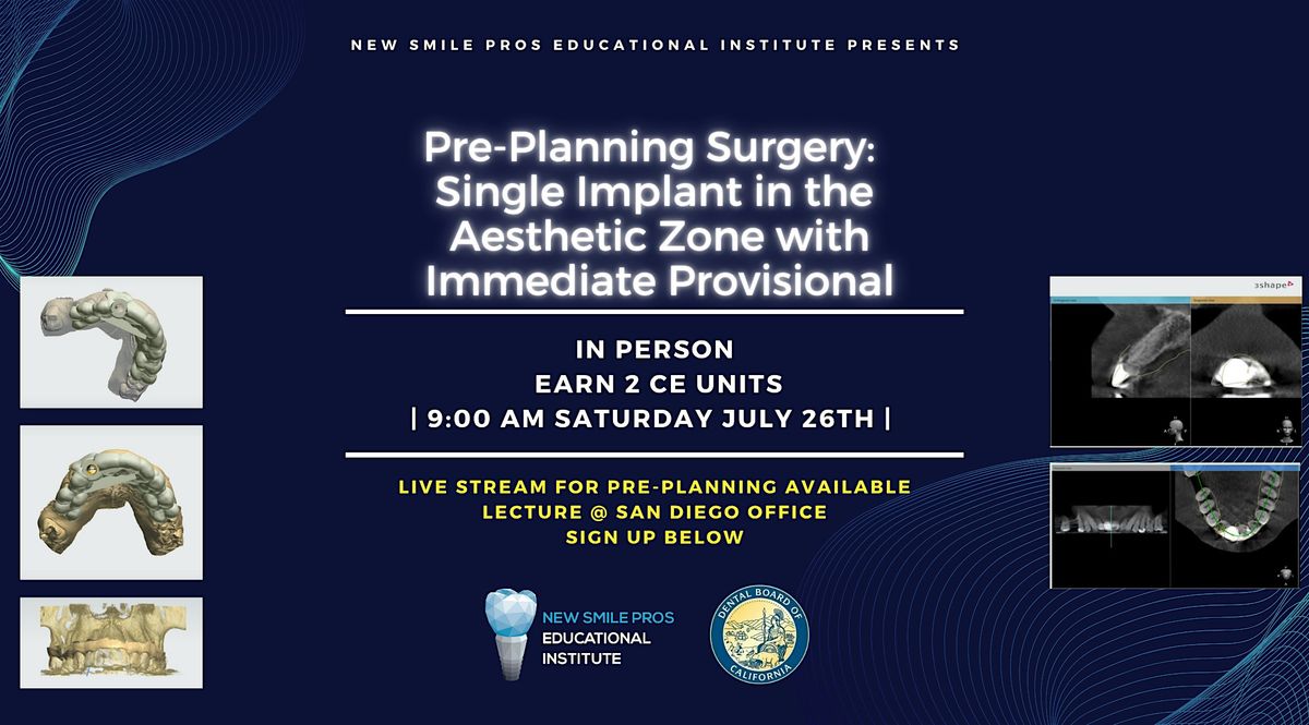 Pre-Surgery: Single Implant Aesthetic Zone Immediate Provisional, 26 July | Event in Murrieta | AllEvents