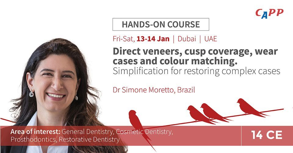 Direct veneers, cusp coverage, wear cases and colour matching