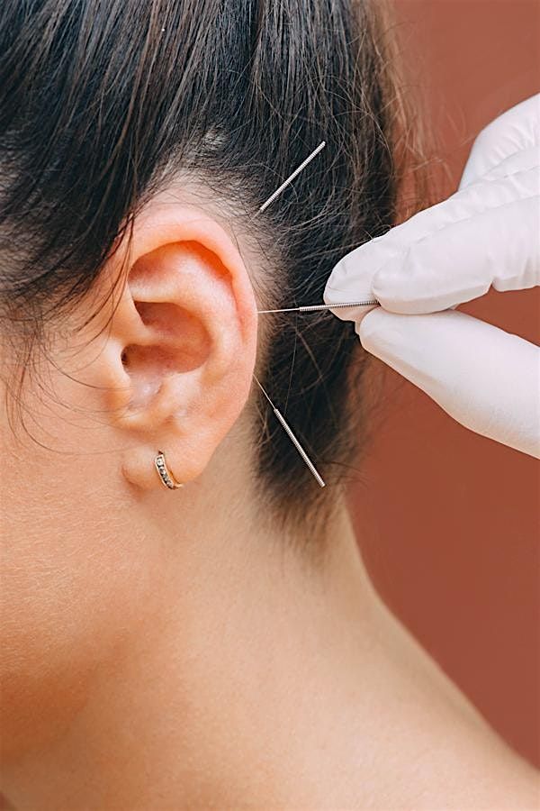 Community Ear Acupuncture for Stress & Anxiety ✨, 14 September | Event in Sutton | AllEvents
