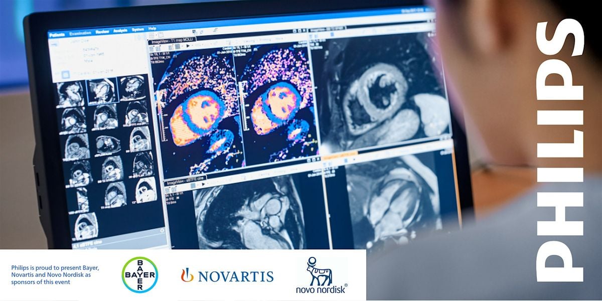 Philips Introduction to Cardiac MRI Course, 18 October | Event in Broadbeach | AllEvents