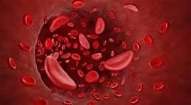 Voices of Hope: A Sickle Cell Gathering for Healing and Health Equity, 13 September | Event in Jacksonville