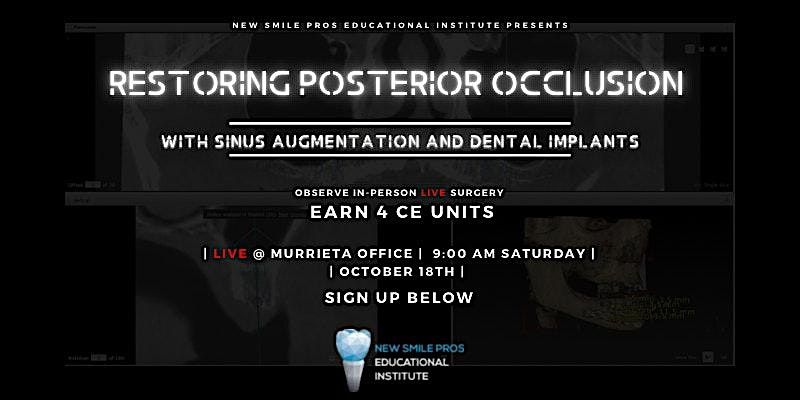Restoring Posterior Occlusion with Sinus Augmentation and Dental Implants, 18 October | Event in Murrieta