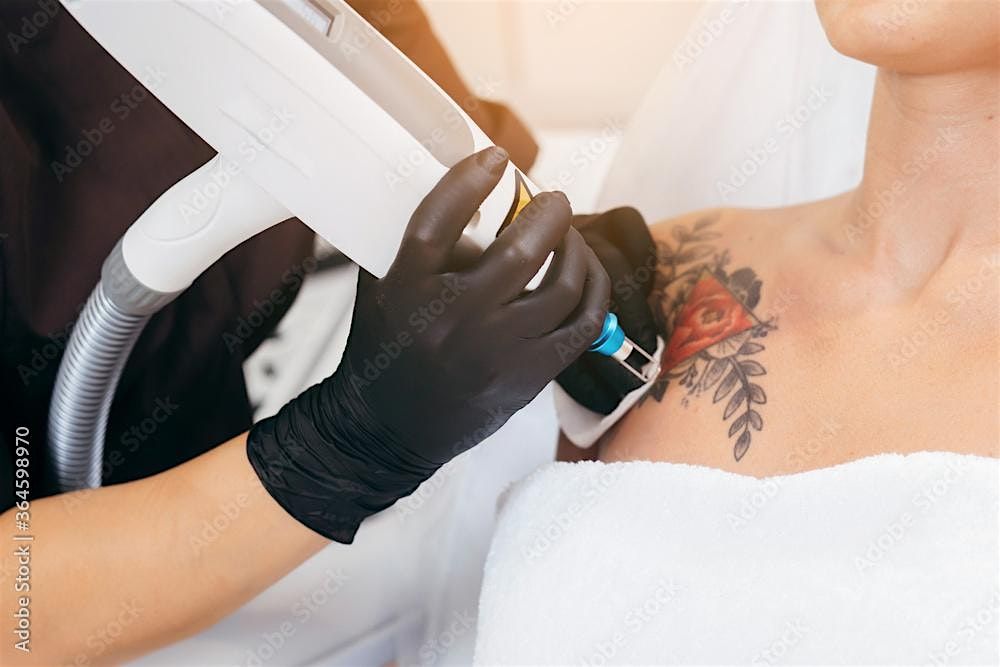 Laser Tattoo Removal Course, 1 January | Event in Dallas | AllEvents
