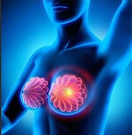 Holistic Breast Care Workshop, 26 September | Event in Plymouth | AllEvents