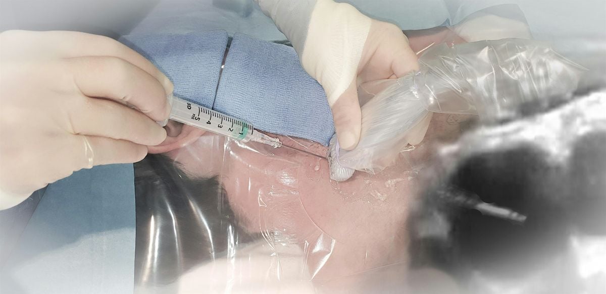 RBH Ultrasound Vascular Access Workshop, 15 December | Event in London | AllEvents