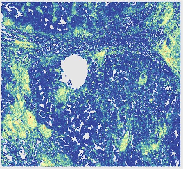 MIG Spatial Transcriptomics Workshop, 13 August | Event in Parkville | AllEvents