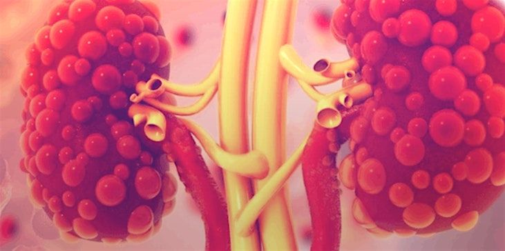Clinical Skills Workshop: End Stage Kidney Disease in Palliative Care, 28 October | Event in Nelson | AllEvents