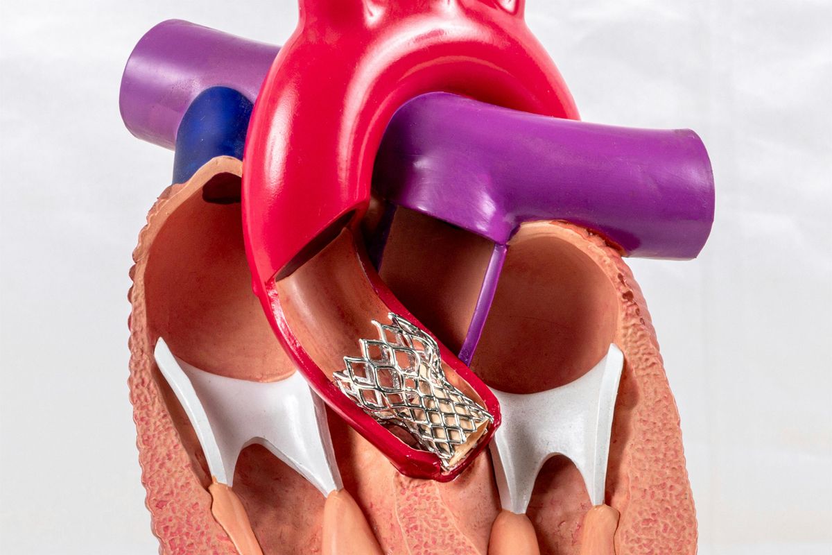 TAVI Planning: A Beginner and Advanced Hands-On Imaging Workshop, 15 December | Event in Manchester | AllEvents