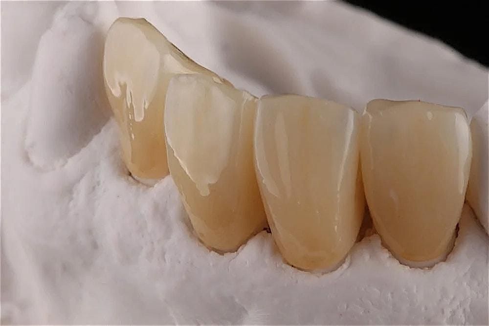 The Simplicity of Zirconia for Complex Restorative Cases, 22 January | Event in Charlotte | AllEvents
