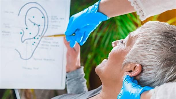 Auriculotherapy with Revive Ear Seeds and Acupuncture | Event in Albany | AllEvents