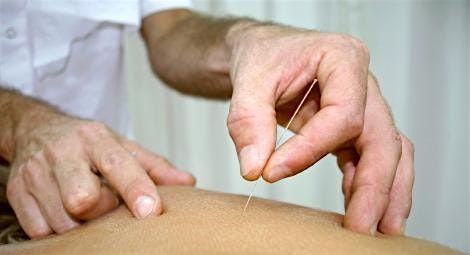 Introduction to Dry Needling - CPD, 18 October | Event in Bournemouth | AllEvents