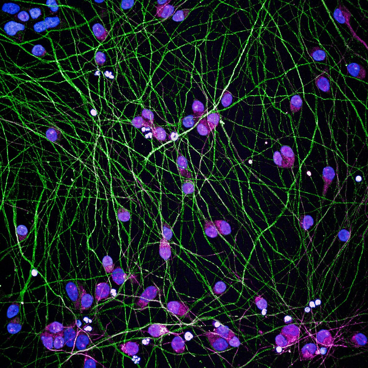 4th European C9orf72 Workshop, 29 January | Event in London | AllEvents