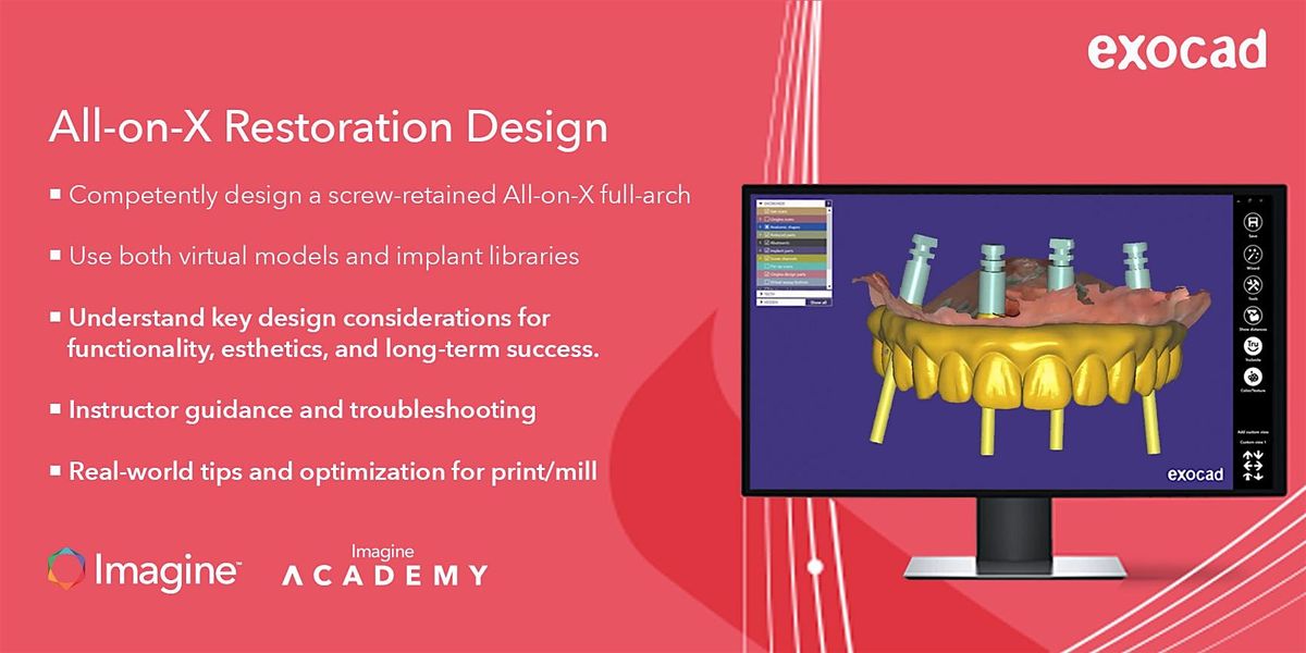 All-on-X Restoration Design in exocad, 18 July | Event in Wakefield | AllEvents