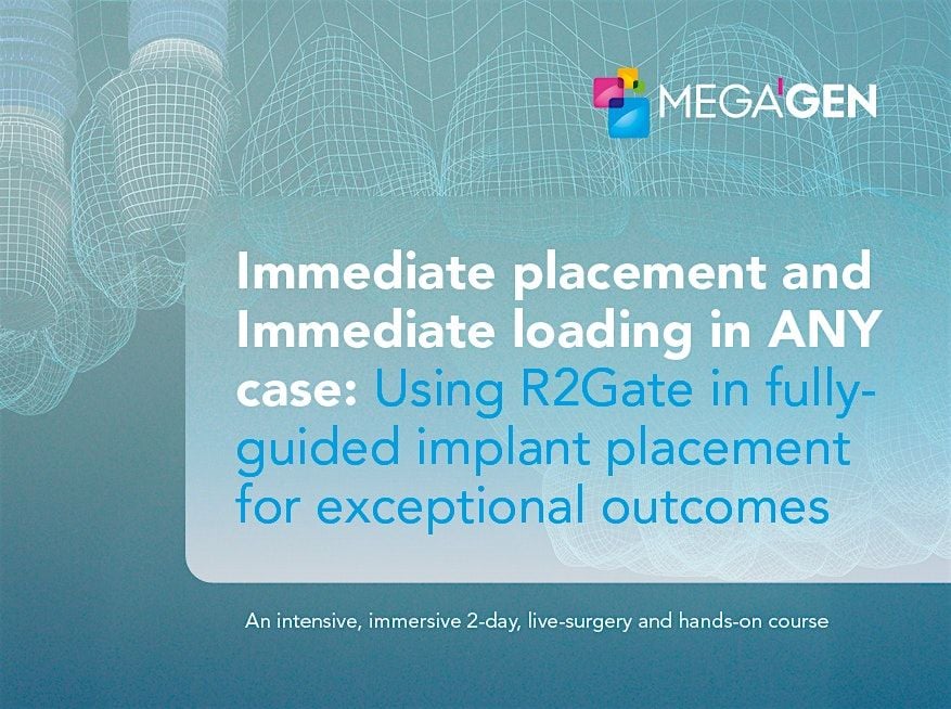 Immediate placement and immediate loading in ANY case using R2Gate, 3 October | Event in Widnes | AllEvents