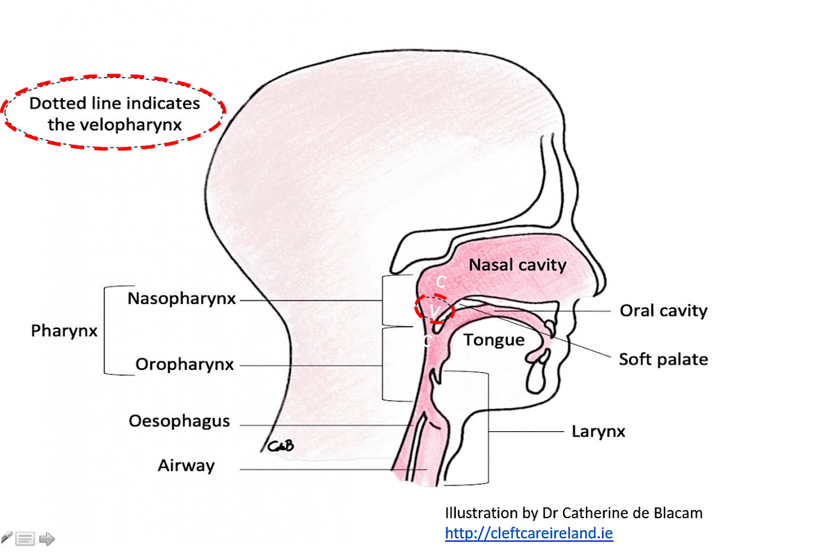 Assessment and Intervention of Cleft Palate Speech and non-Cleft VPD, 30 September | Event in Dublin 8 | AllEvents