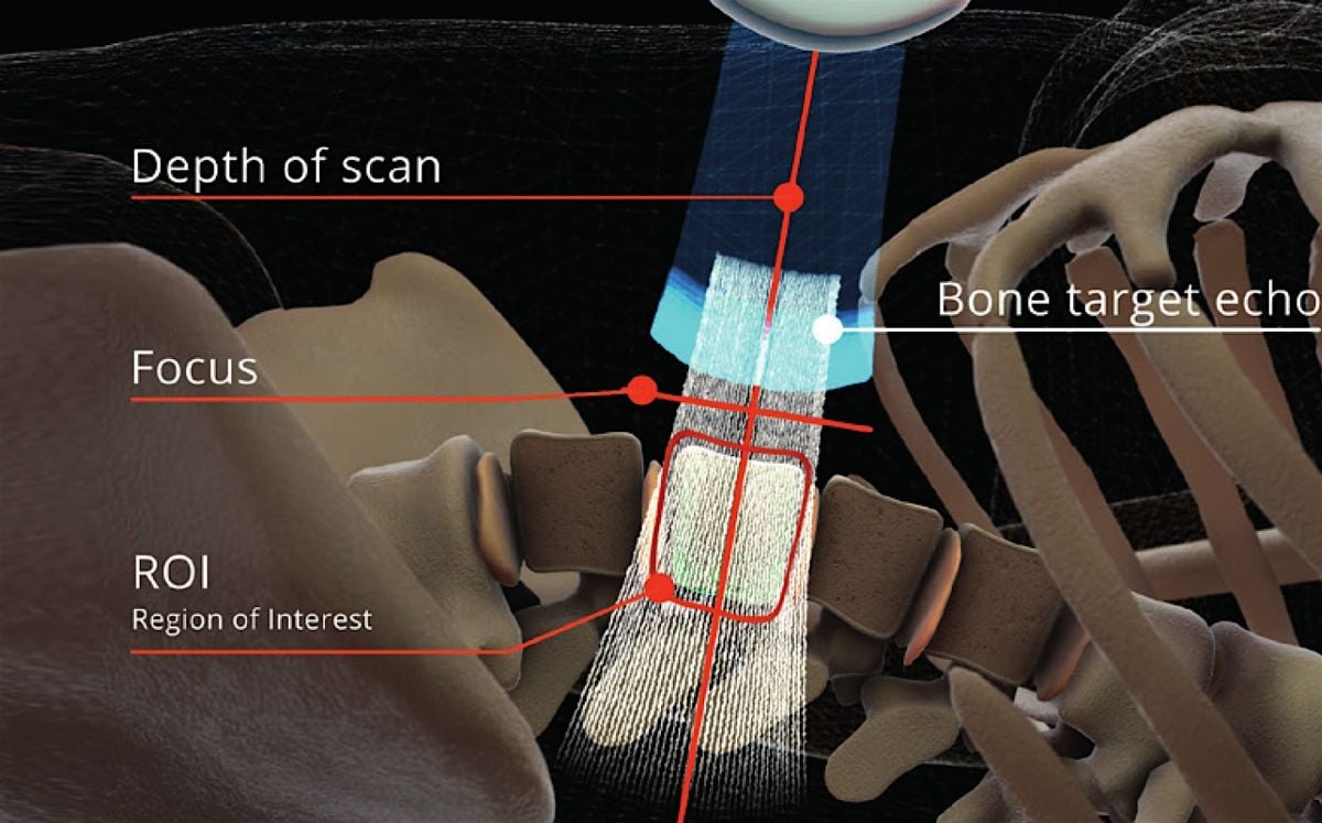 REMS Bone Scan Event – Track & Improve Your Bone Health Naturally, 15 September | Event in Naples | AllEvents