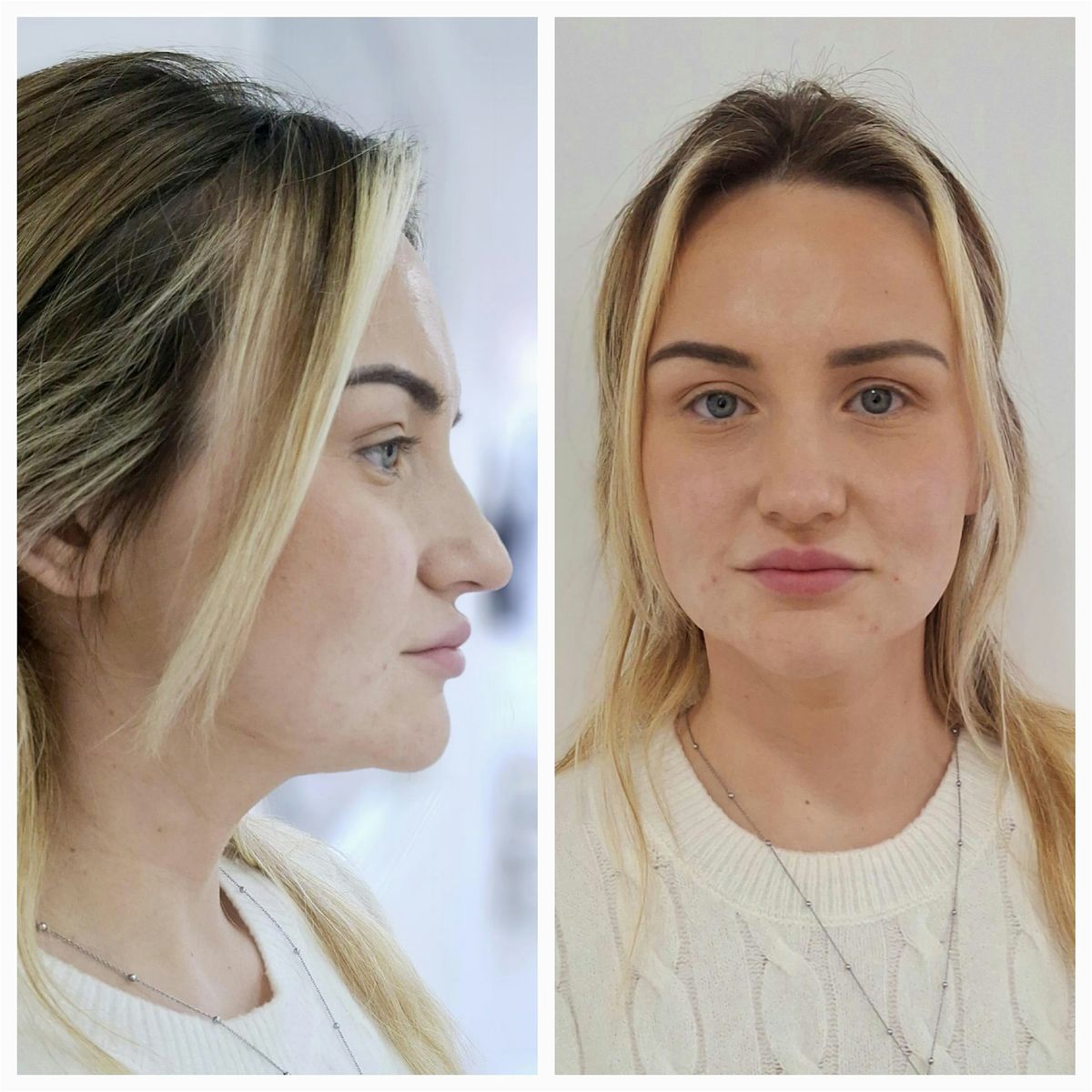A/SYMMETRY® AESTHETICS LAUNCH!, 1 June | Event in Ipswich | AllEvents