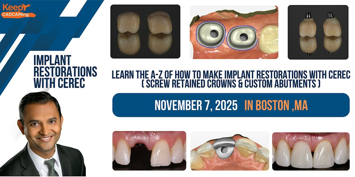 Implant  Restorations  with CEREC (Boston,MA), 7 November | Event in Wilmington | AllEvents