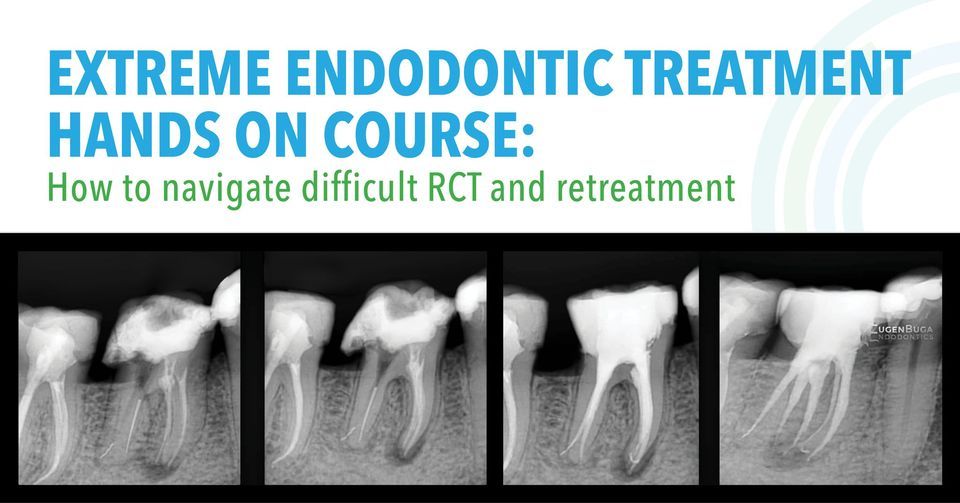 Extreme Endodontic Treatment Hands on Course, 5055 Satellite Dr, Mississauga, ON L4W 5K7, Canada