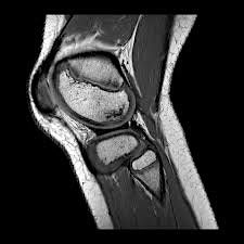 Imaging of the Knee (Session 3), 10 October | Event in Bournemouth | AllEvents